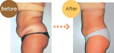 Does body shaping work? How many hours can I wear a body shaper?